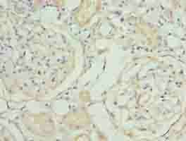 MAT2A Antibody