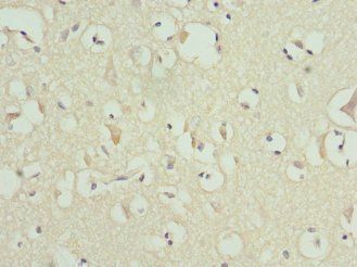 MATK Antibody