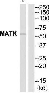 MATK Antibody