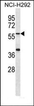 MATN1 antibody