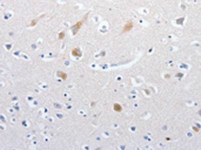 MATN1 antibody