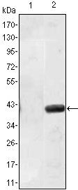 MATN1 Antibody