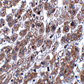 MATN1 Antibody