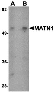 MATN1 Rabbit Polyclonal Antibody