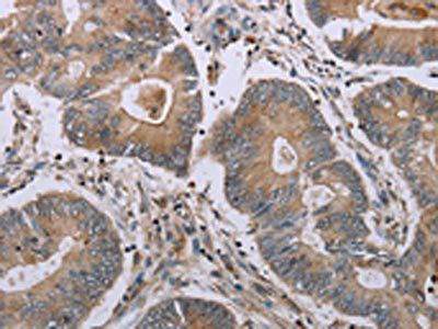 MAVS Antibody