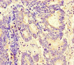 MAX Antibody