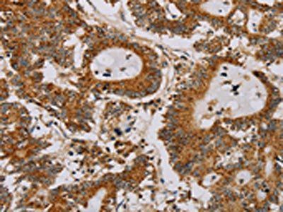 MB Antibody
