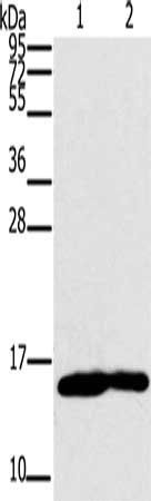 MB antibody