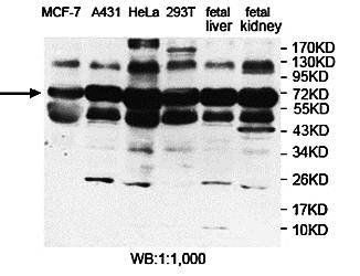 MBD1 antibody