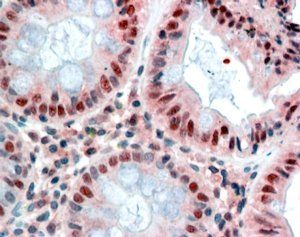 Goat anti-MBD2 (isoform 1) Antibody