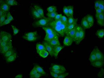 MBNL3 Antibody