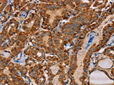 MBNL3 Antibody