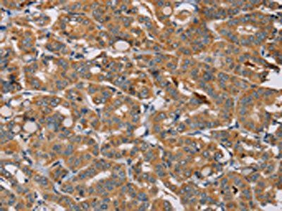 MBNL3 Antibody