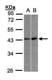 MBNL3 antibody [N1C3]