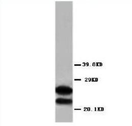 Anti-Myelin Basic Protein/MBP Antibody
