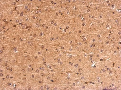 MC1 Receptor Rabbit Polyclonal Antibody