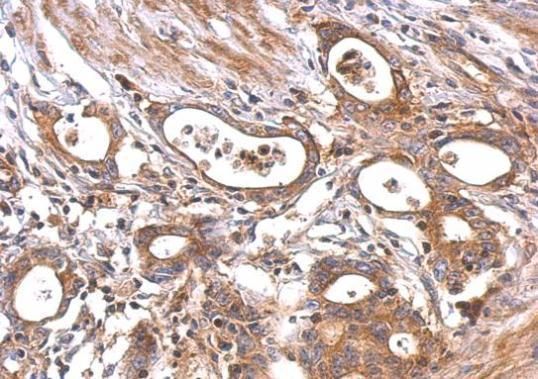 MC1 Receptor antibody [C2C3], C-term