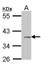 MC1 Receptor antibody [C2C3], C-term