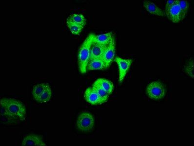 MC3R antibody