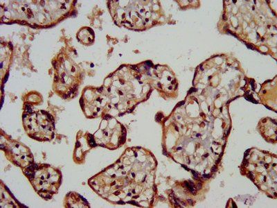 MC3R Antibody