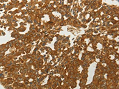 MC4R Antibody