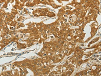 MC4R Antibody