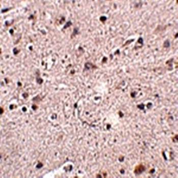 MC4R Rabbit Polyclonal Antibody