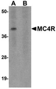 MC4R Rabbit Polyclonal Antibody