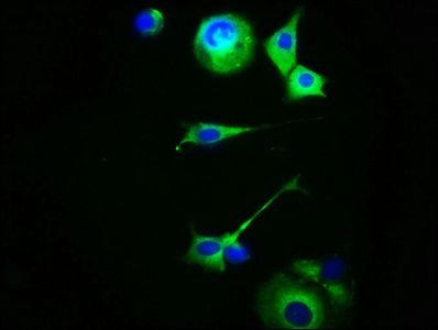 MC5R Antibody