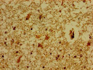 MC5R Antibody