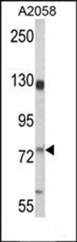 CD146 antibody