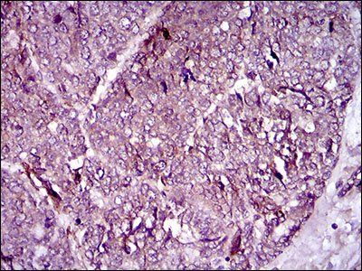 MCAM Antibody