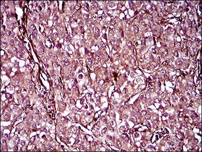 MCAM Antibody