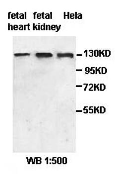 MCAM Rabbit Polyclonal Antibody