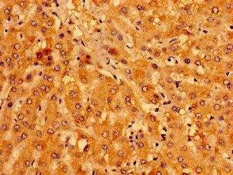 MCAT Antibody