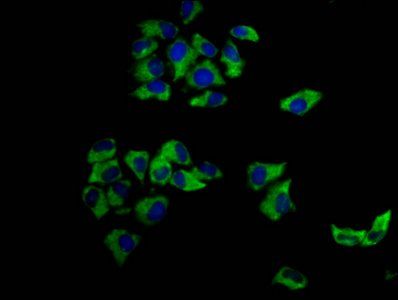 MCC Antibody