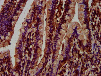 MCC Antibody