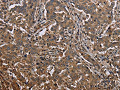 MCC Antibody