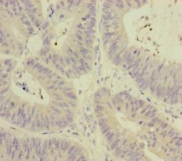 MCCC1 Antibody