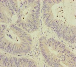 MCCC1 antibody