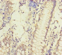 MCCC1 Antibody