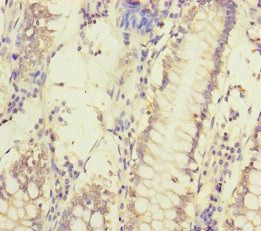 MCCC1 antibody