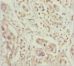 MCCC2 antibody