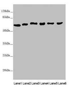 MCCC2 Antibody