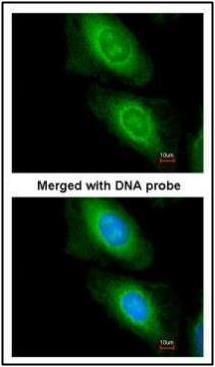 malonyl-CoA decarboxylase Antibody
