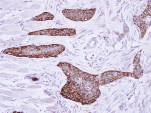 MCD antibody [N2C1], Internal