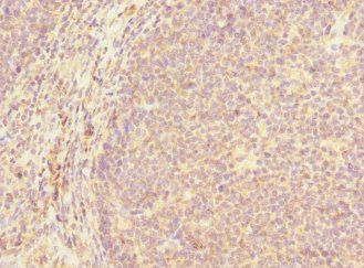 MCF2L Antibody