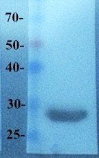 mCherry antibody