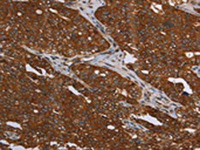 MCHR1 Antibody
