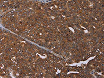 MCHR1 Antibody